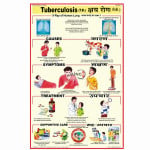 Tuberculosis Chart